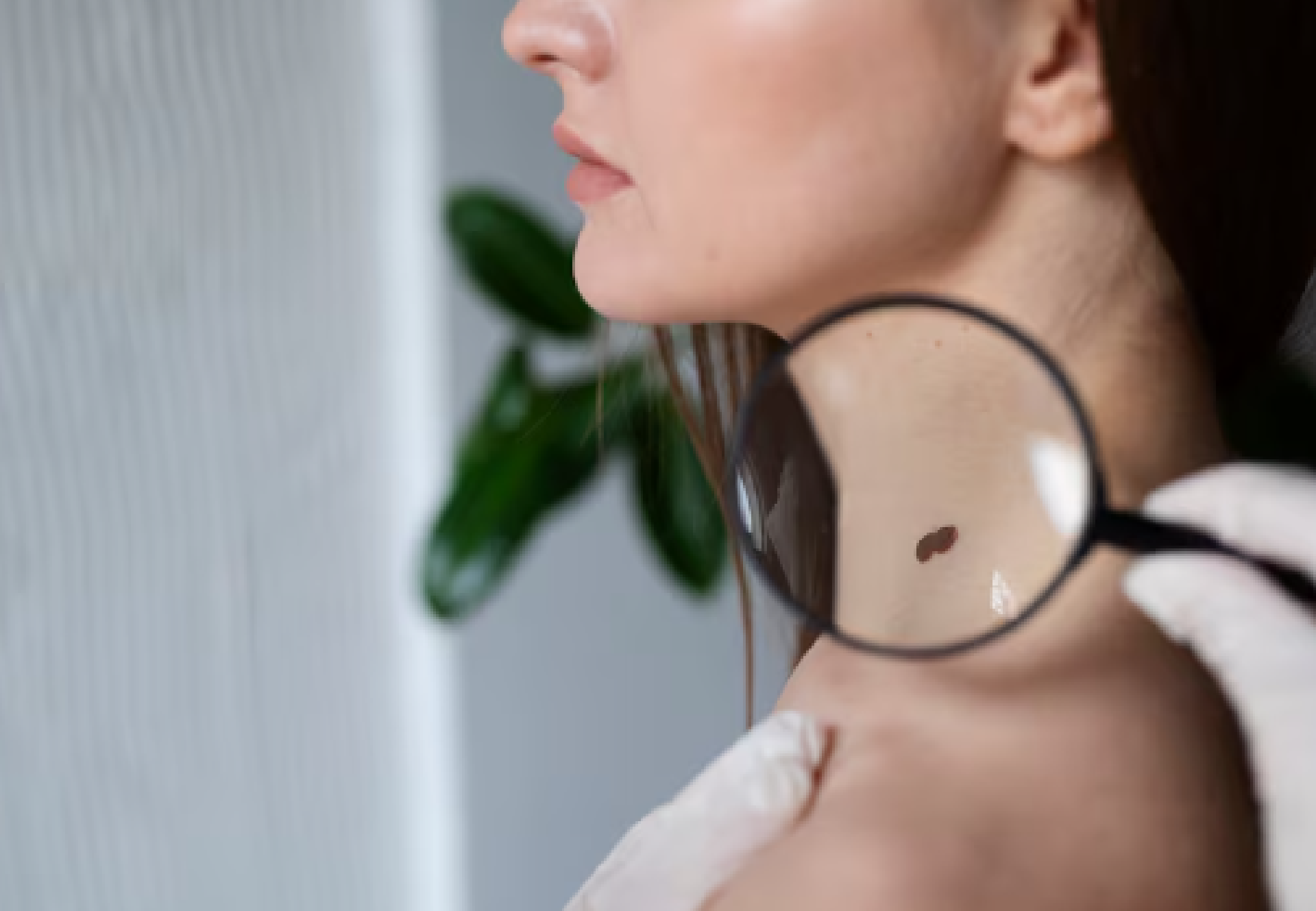 Especialista destaca diagnóstico precoce no combate ao câncer mais comum no Brasil