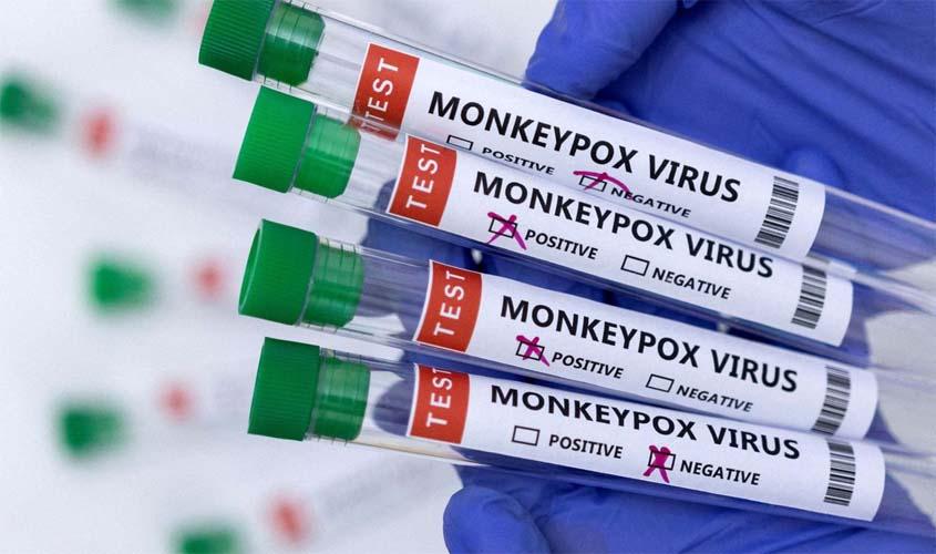 Ministro diz que Brasil terá antiviral para tratar varíola dos macacos